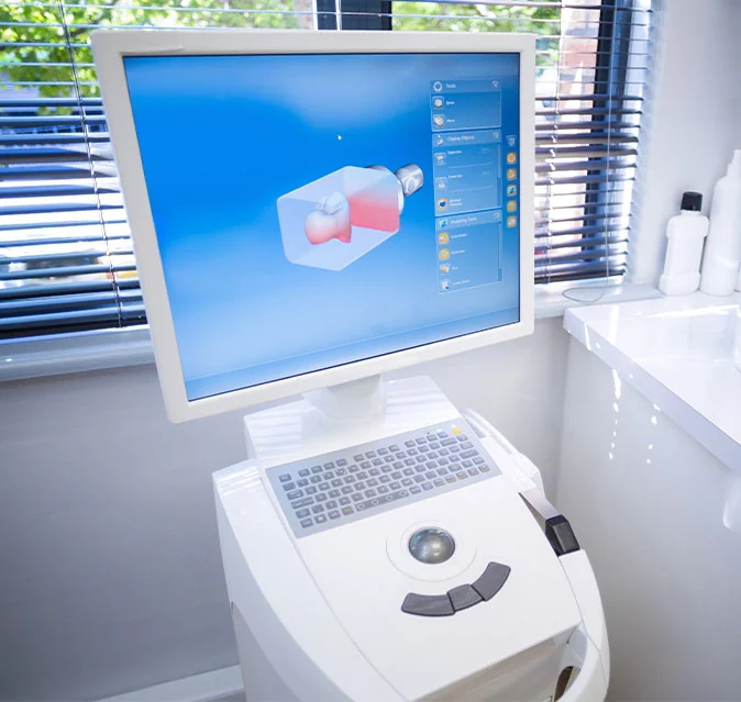 iTero digital scanner